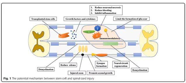 脊髓損傷最新進(jìn)展,脊髓損傷最新進(jìn)展